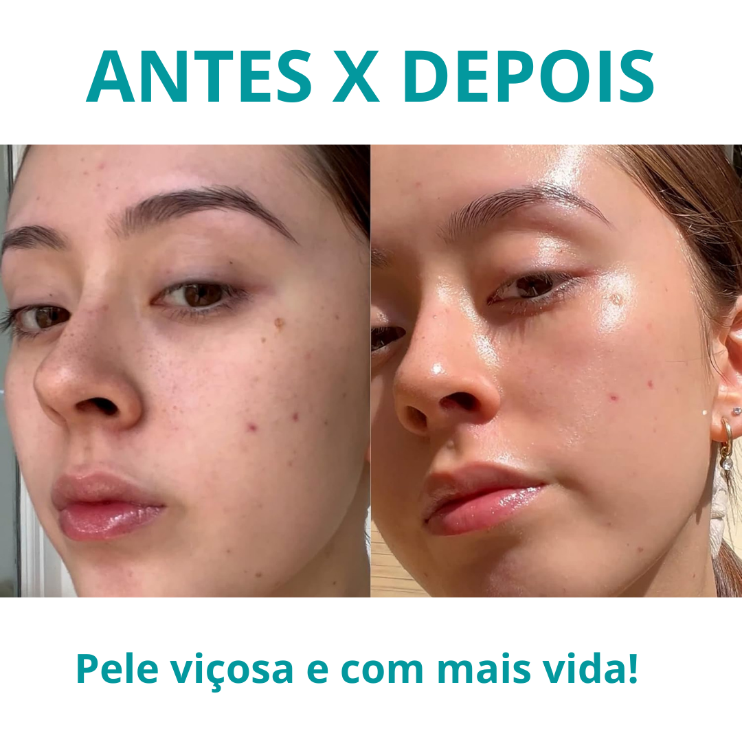 BoosterSkin Pro - Aparelho Facial Coreano