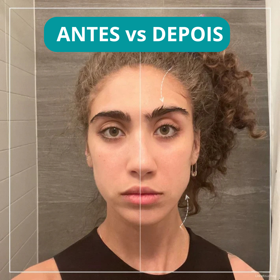 SkinGlow - Lifting Facial