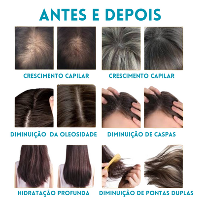 LedTerapy - Escova de Fototerapia